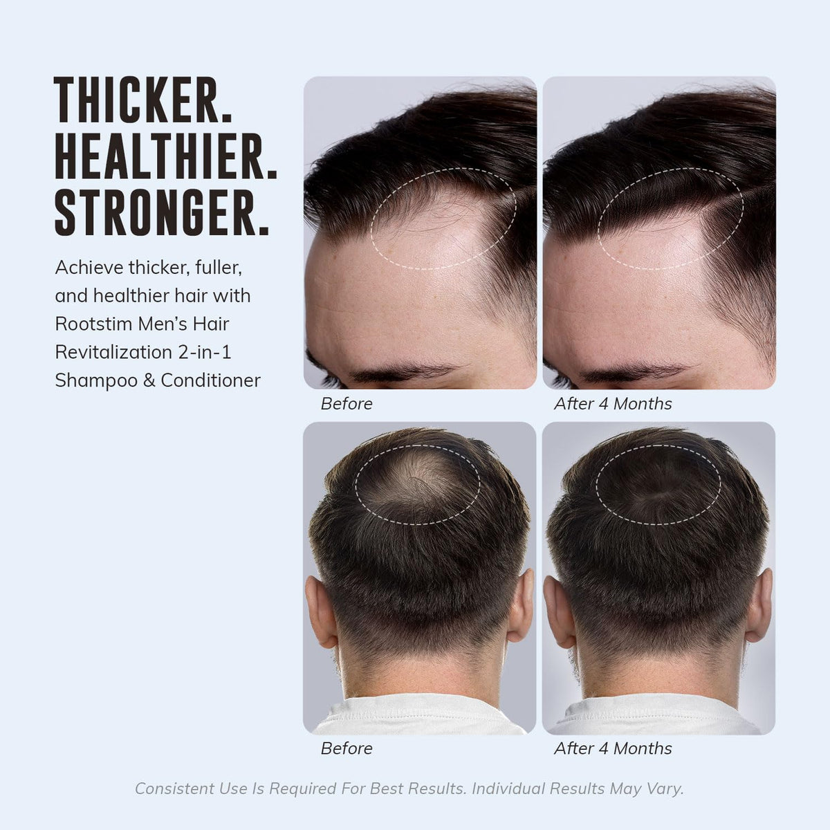 DHT Blocking Shampoo for Men - RootStim Official Imagery - 5