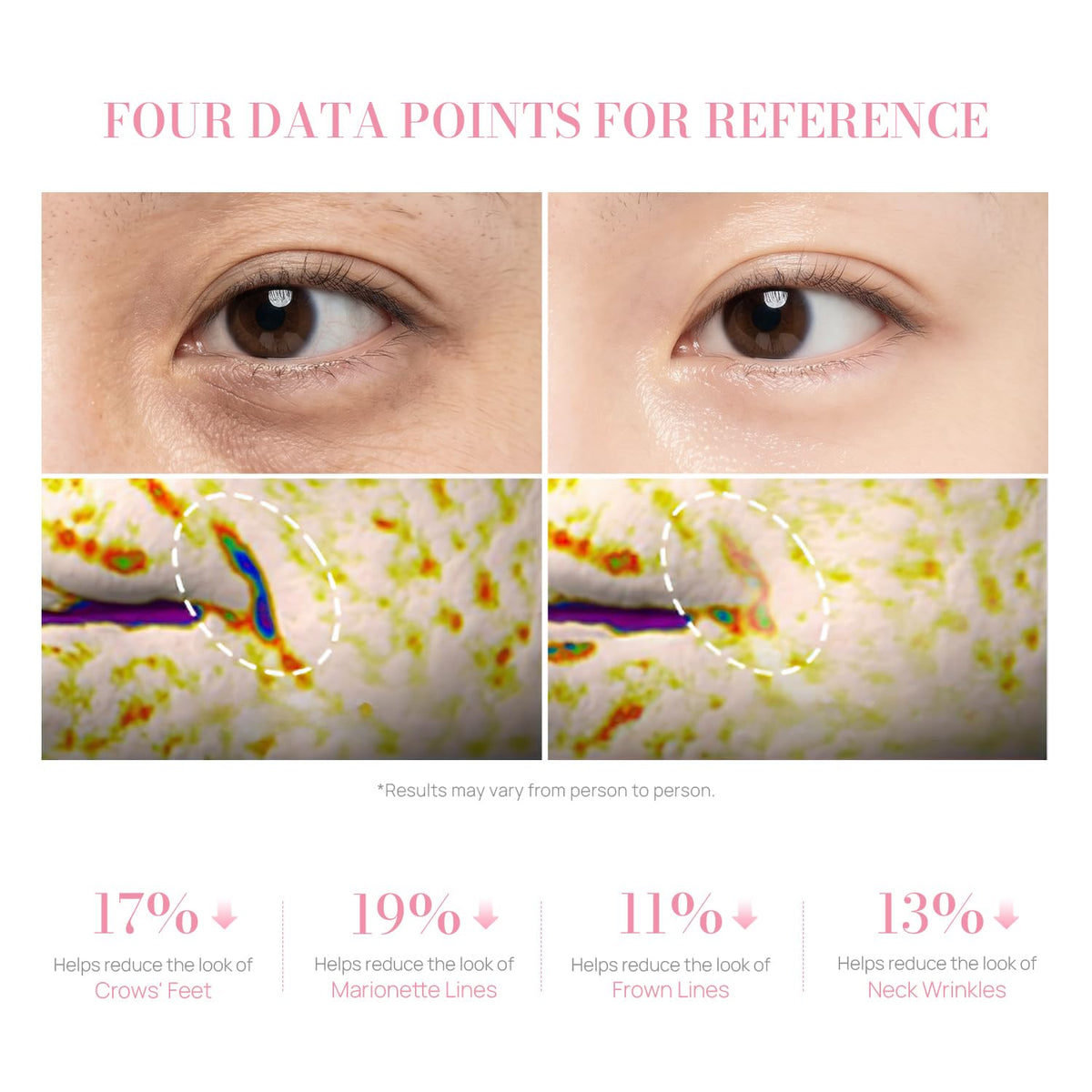 PDRN Pink Collagen Volume Multi Balm Stick Helps Hydrate - Sprnmik Official Imagery - 4