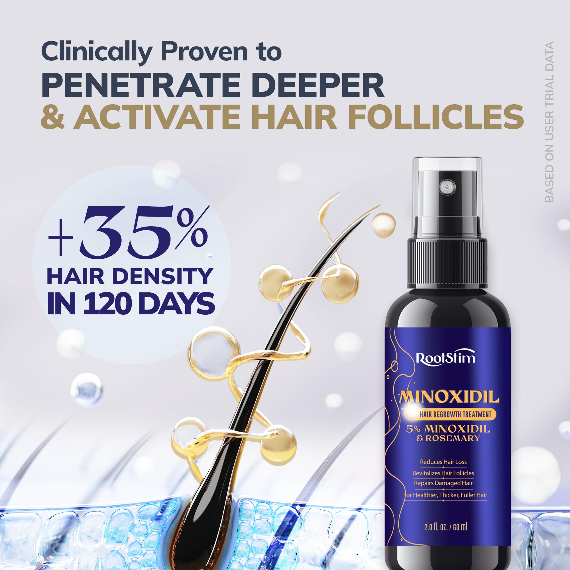 5 Minoxidil Spray 0 25mm Derma Roller Hair Growth Kit for - RootStim Official Imagery - 4