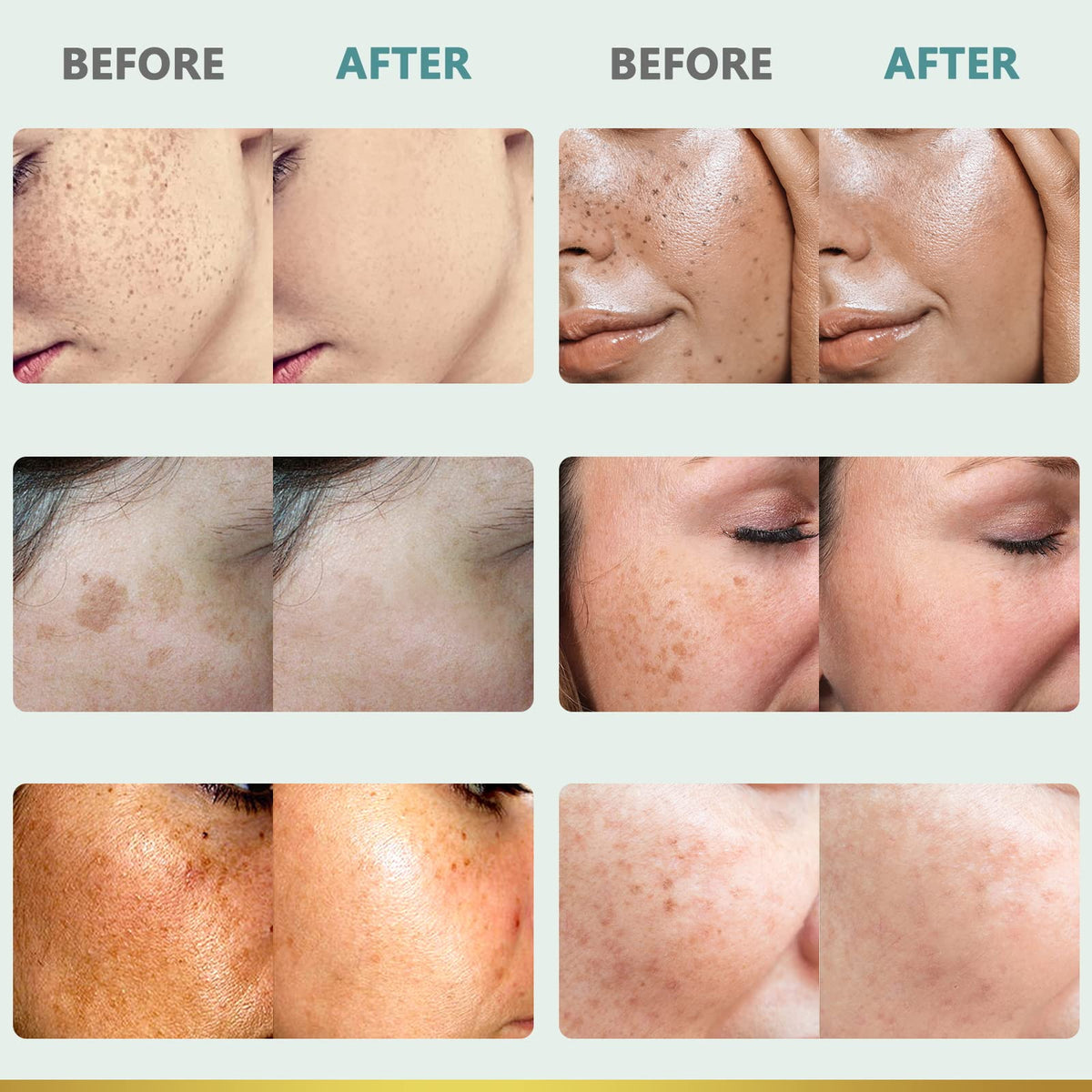 Dark Spot Remover for Face Dark Spot Corrector Cream - CITYGOO Official Imagery - 5
