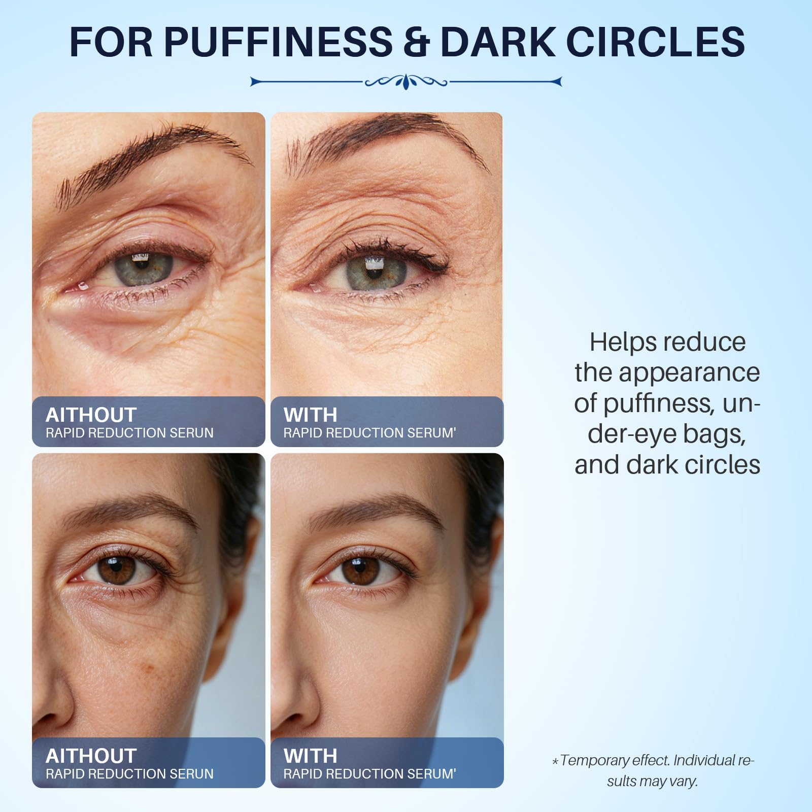 Instant Lift Eye Serum for Dark Circles Puffiness Anti Bag - meisiuri Official Imagery - 5