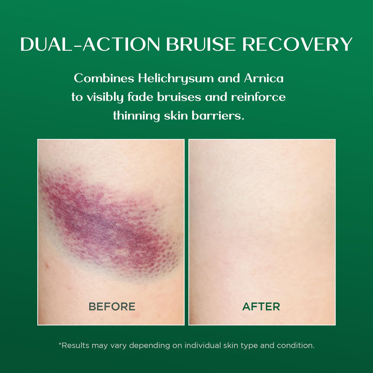 Vigority Arnica Bruise Cream Arnica Cream for Bruises Mature - Vigority Official Imagery - 5