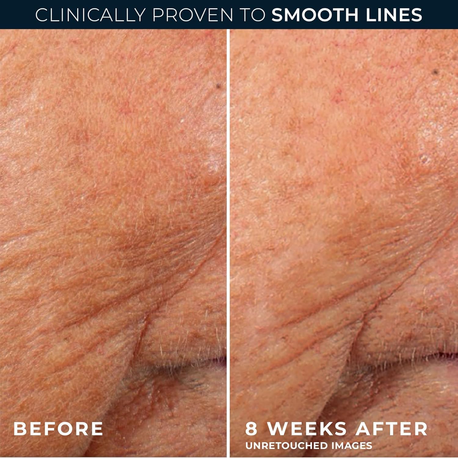 RoC Retinol Correxion Anti Aging Wrinkle Night Serum - RoC Official Imagery - 6