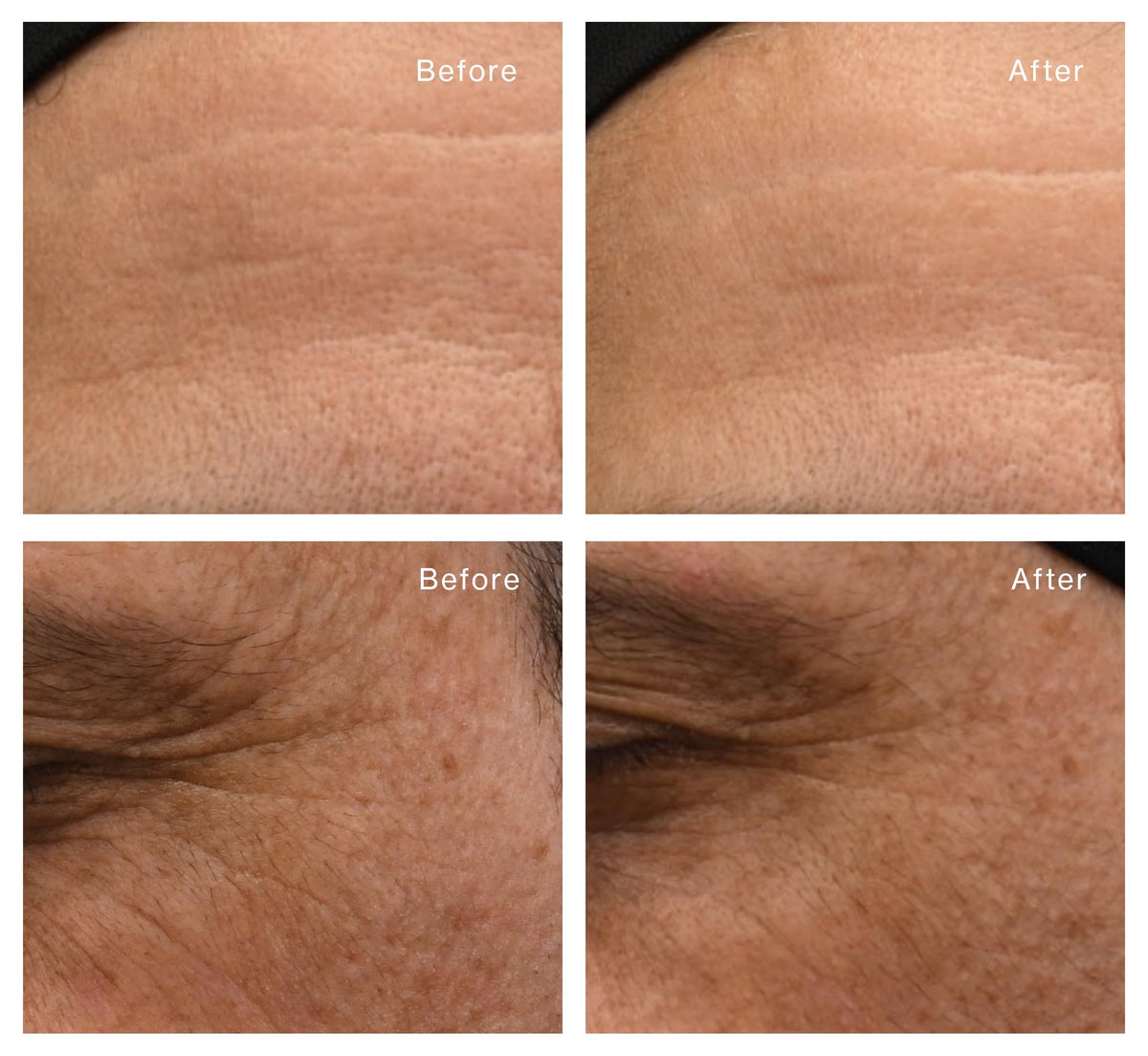 Beauty Crush Triple Action ExoCellular Antioxidant Serum - BeautyCrush Skincare Official Imagery - 4