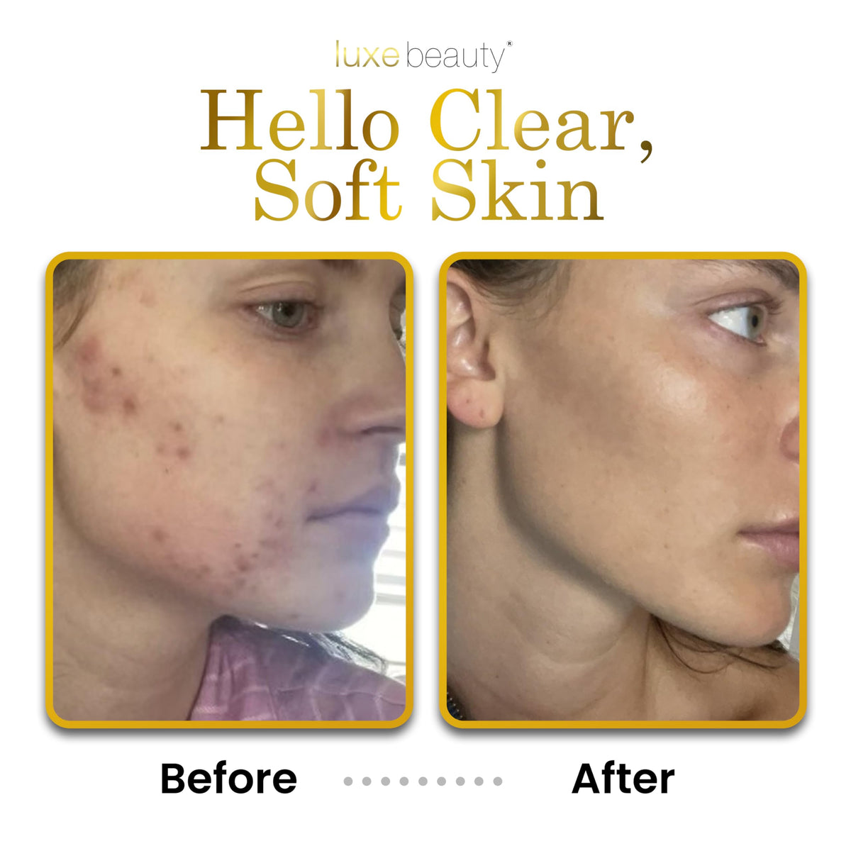 Non Greasy Hyaluronic Acid Moisturizer for Face Neck Hands - LUXE Beauty Lash & Brow Growth Products Official Imagery - 6
