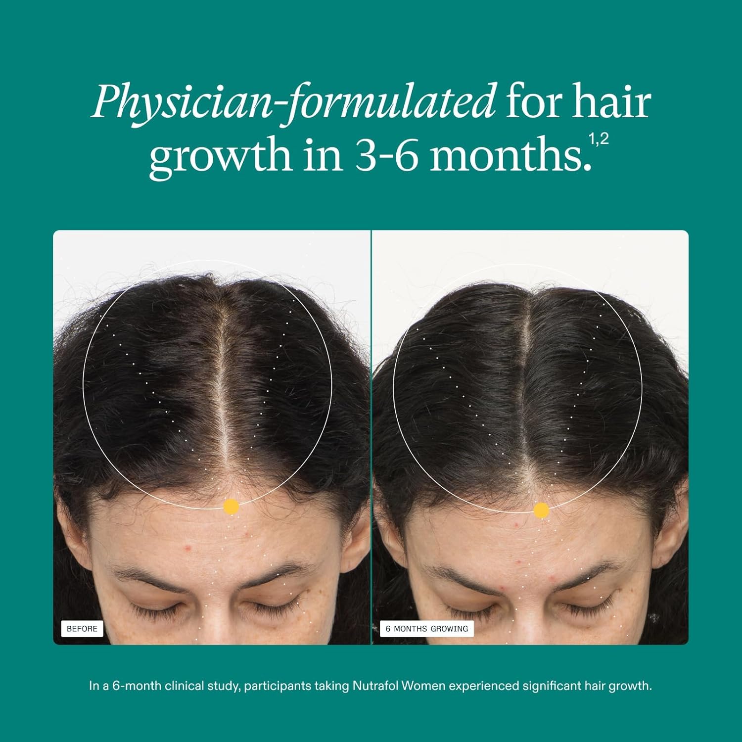 Elefair Nutrafol Women's Hair Growth Supplements for ages 18-44, clinically proven, in a bottle with capsules.