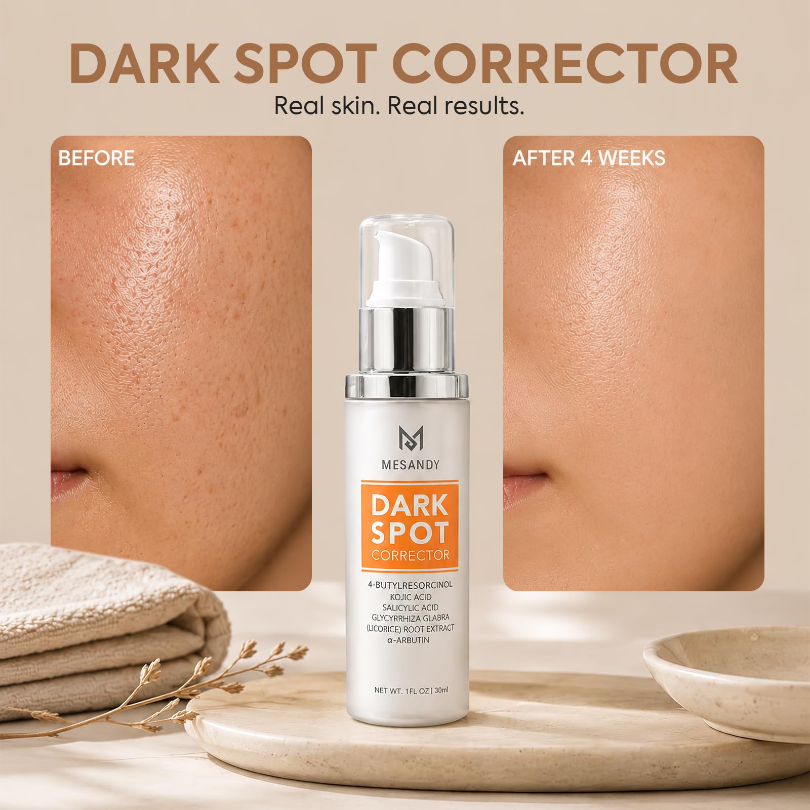 MESANDY dark spot corrector serum with niacinamide and kojic acid for brightening and skin tone improvement.