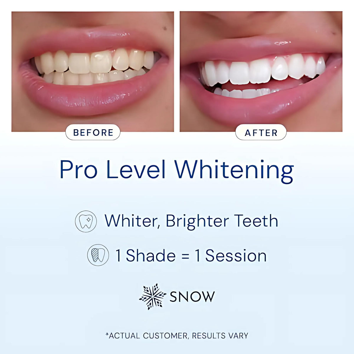 SNOW Teeth Whitening Kit - SNOW Official Imagery - 3