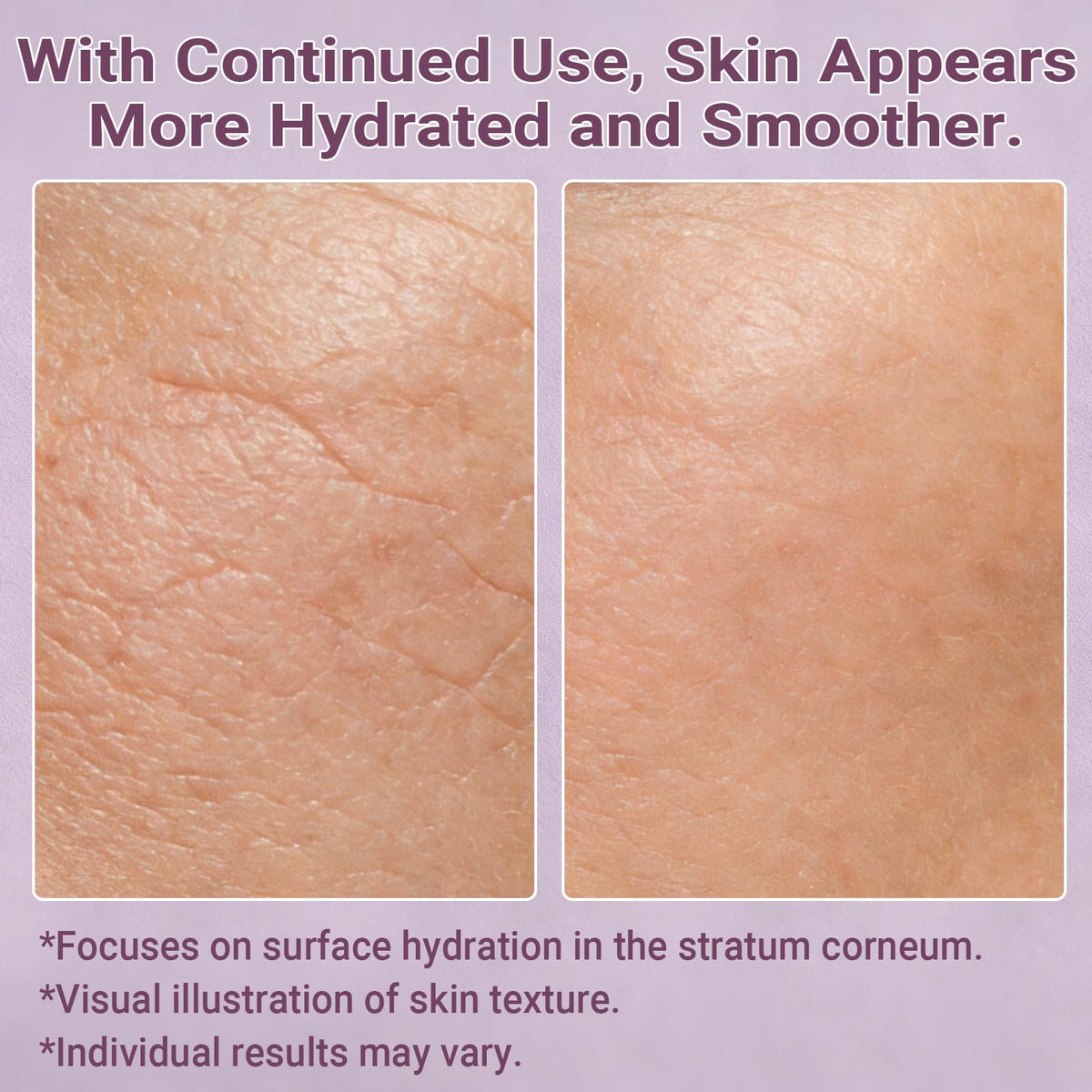 NAD Bifida Peptide Anti Aging Moisturizer - LANDISO Official Imagery - 6