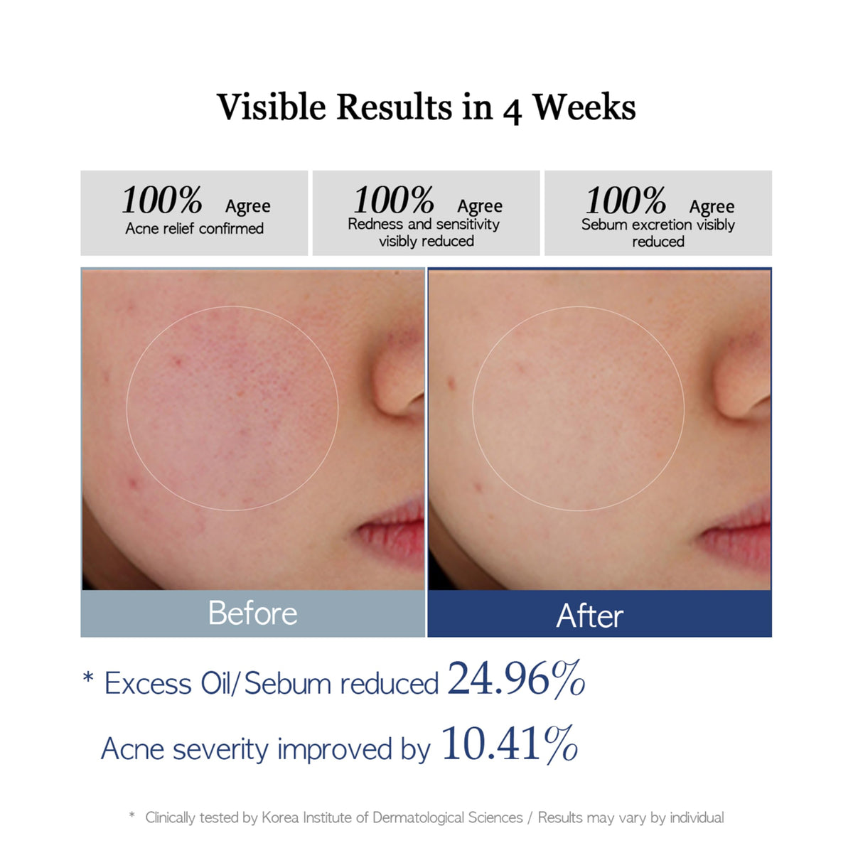 Re SPN PHA Glass Skin Toner Pads - AlwayNu Re.SPN Official Imagery - 5