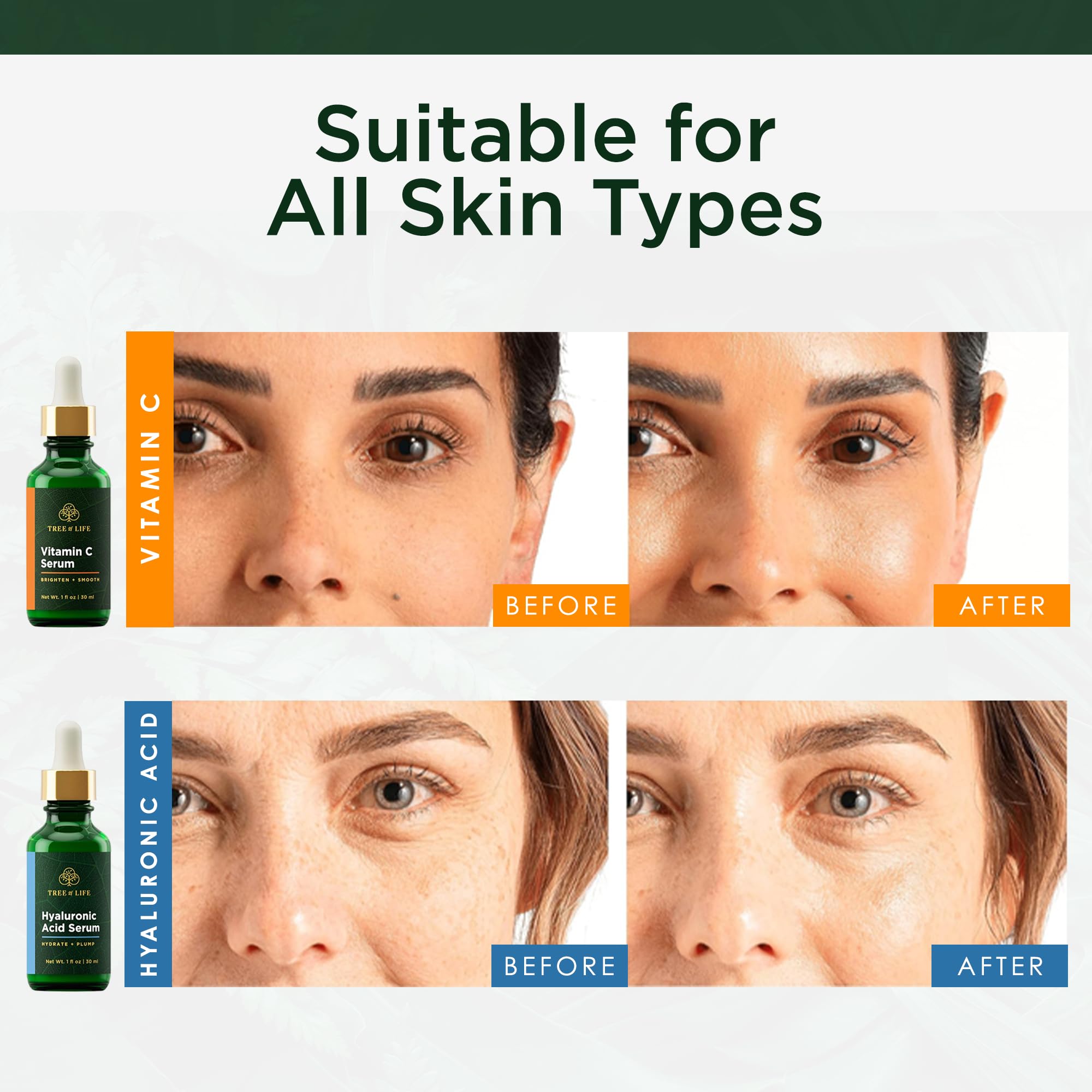 Tree of Life Face Serum Skin Care, Facial Serum and Men, Set of 2 - Tree of Life Official Product View 4