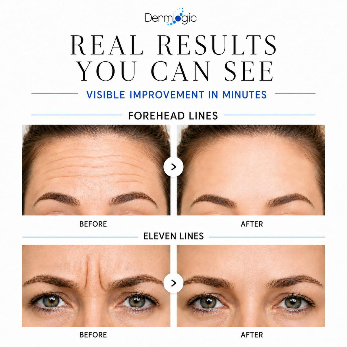 Under Eye Puffiness Dark Circles Rapid Treatment Instantly - Dermlogic Official Imagery - 7