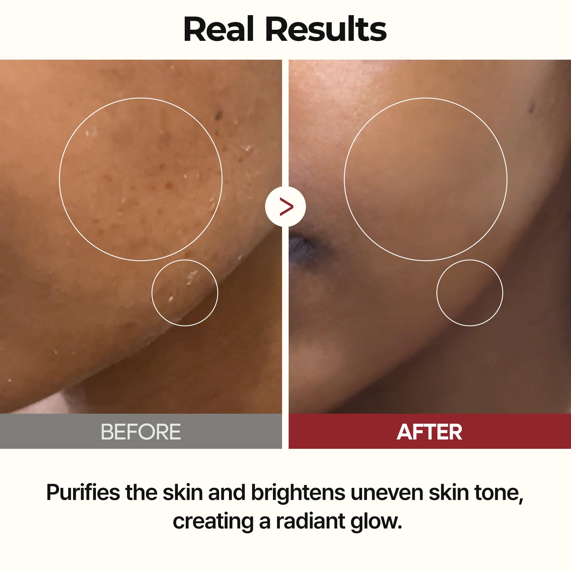 Dr.Melaxin Peel Shot Glow Rice Toner with Rice Extract & Ceramides, Hydrating & - Dr.Melaxin Official Product View 7