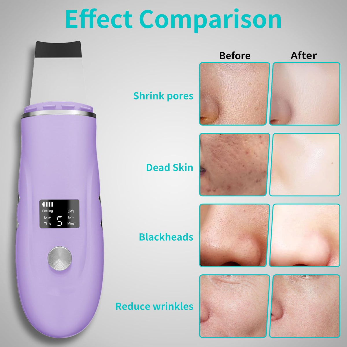 Face Scrubber Skin Spatula - QYCSL Official Imagery - 5