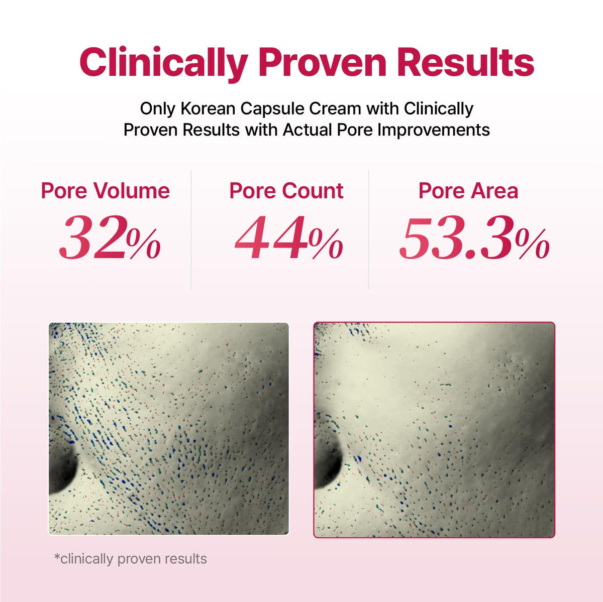 YADAH Collagen Hydra Core Cream 1 76 oz 50g Deep Hydration - YADAH Official Imagery - 6