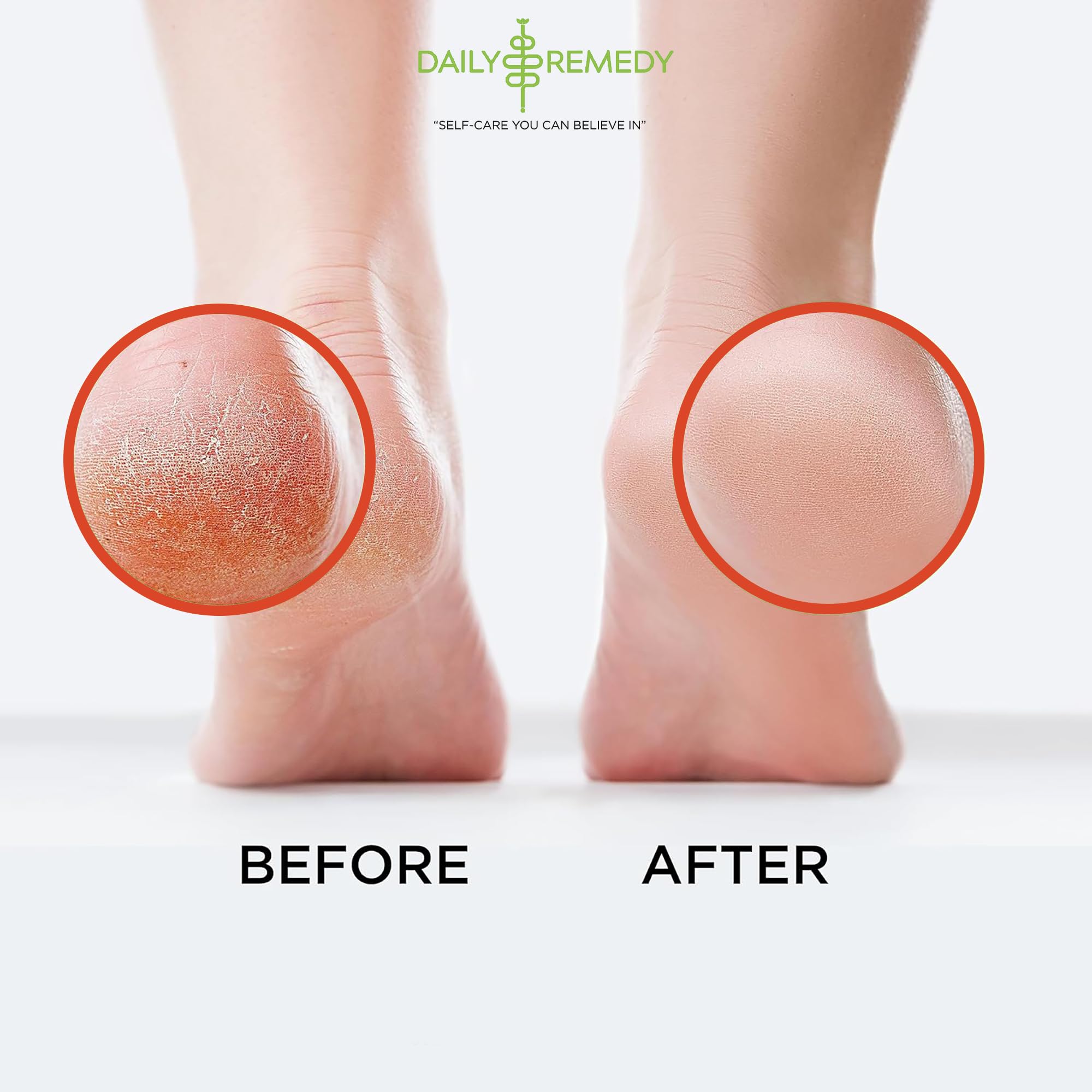 Daily Remedy Muscle Relief Foot Soak with Epsom Salt 1lb