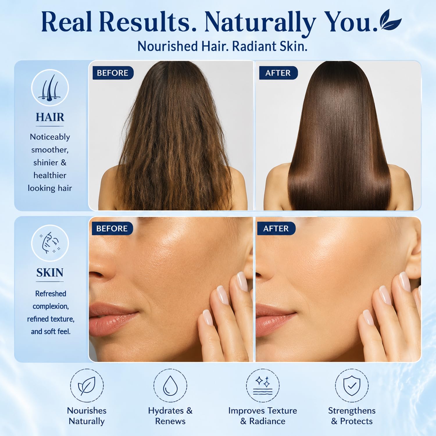 Nexon Botanics Rosehip Oil for Face 8 fl oz - Hydrating Facial Oil for Gua Sha - Nexon Botanics Official Product View 3