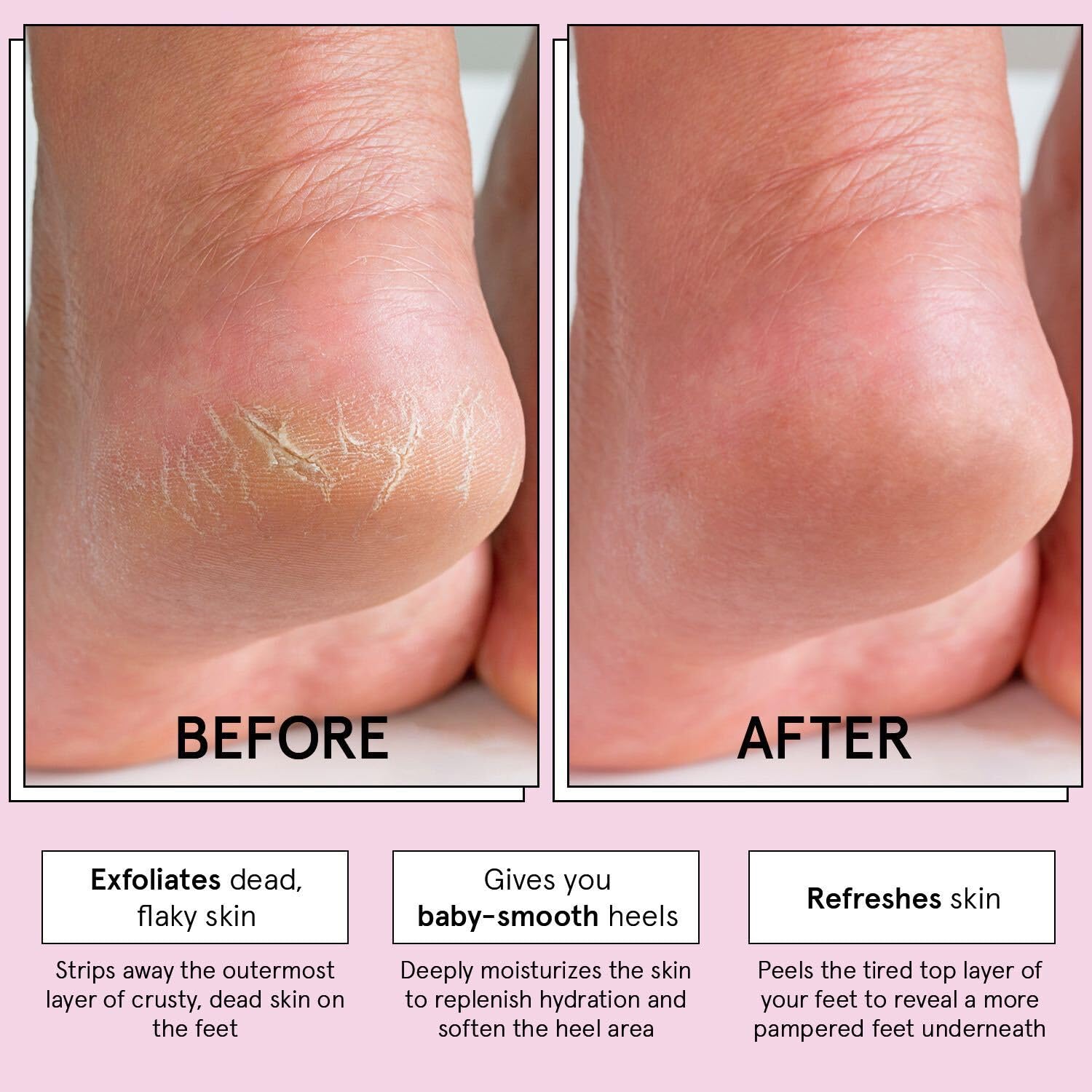 grace & stella Award-Winning Foot Peel Mask - View 4