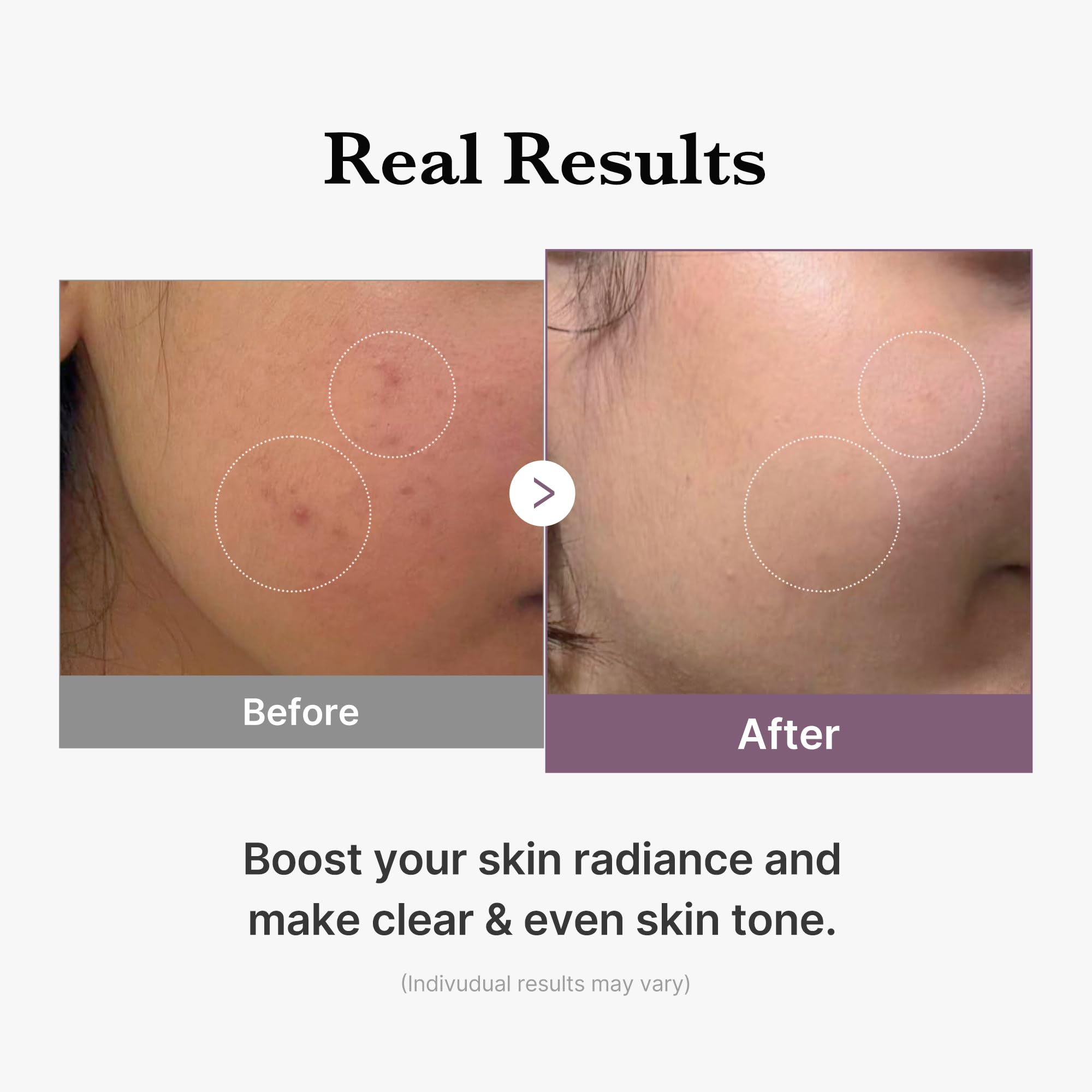 medicube Age-R Glutathione Glow Milky Toner - medicube