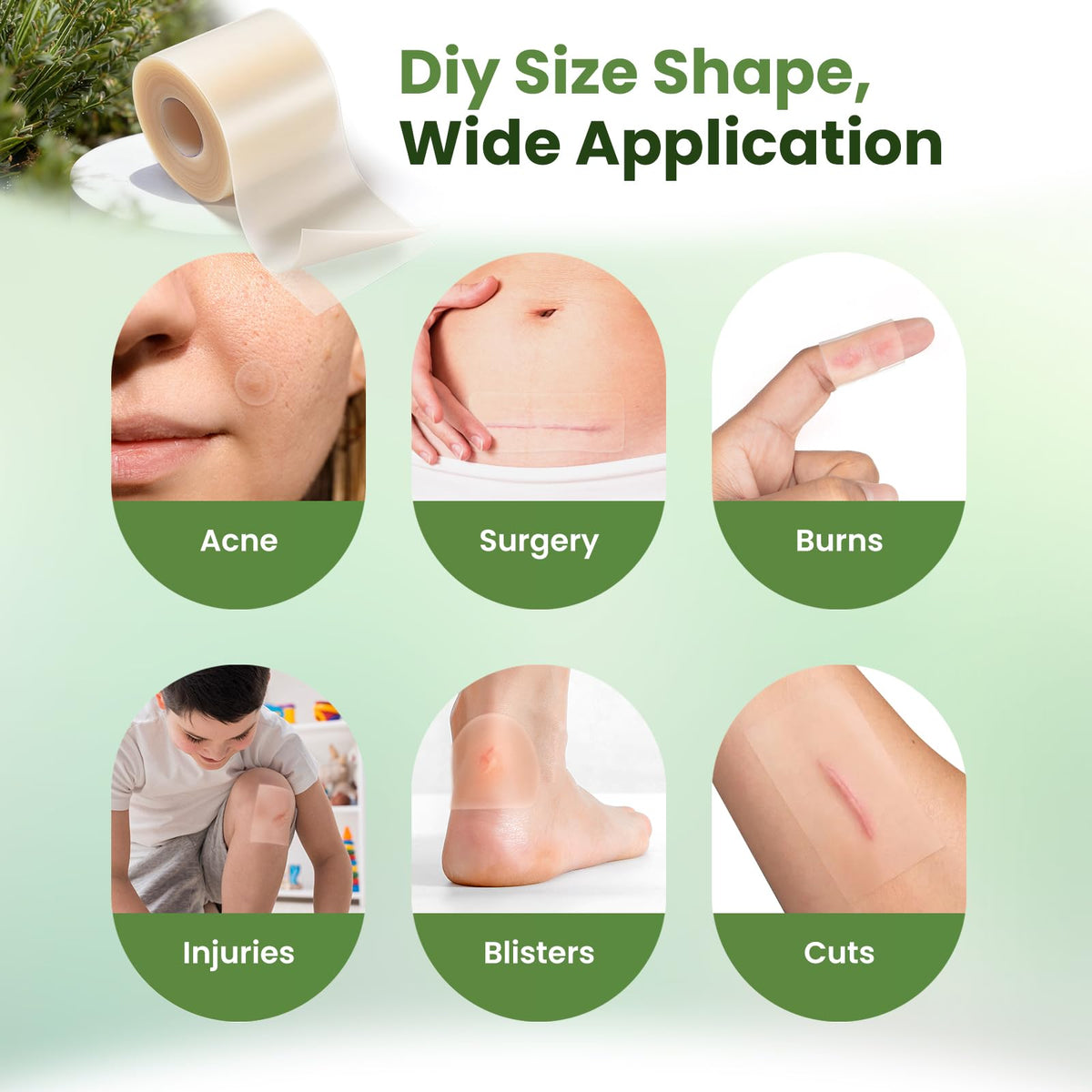 Hydrocolloid Roll Gel Bandages - Kimihome Official Imagery - 7