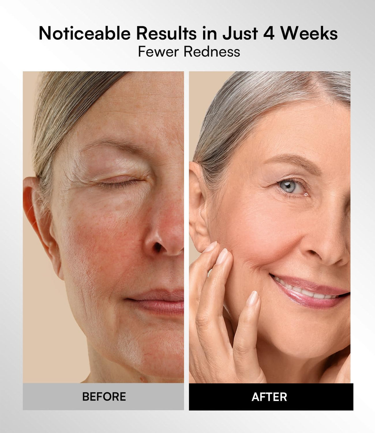 INIA Red Light Therapy Mask for Face 850nm NIR Red Blue LED - INIA Official Imagery - 7
