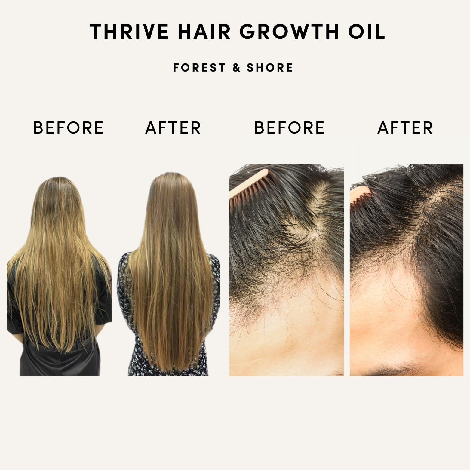 Forest & Shore Hair Growth Oil, 100% Natural, with Caffeine, Biotin, Castor , - Forest & Shore Official Product View 3