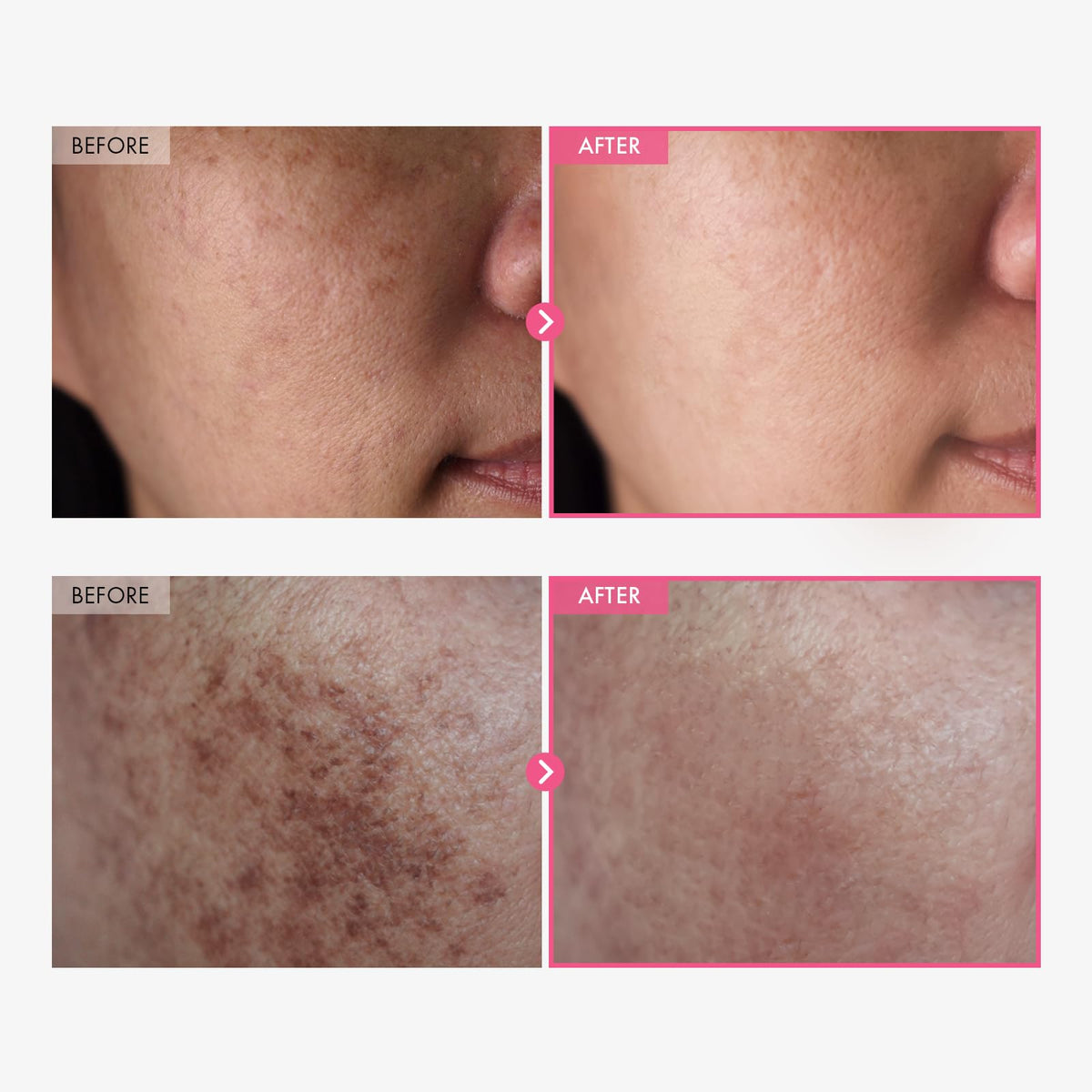 TOSOWOONG Glass Skin Recovery Bundle - TOSOWOONG Official Imagery - 7