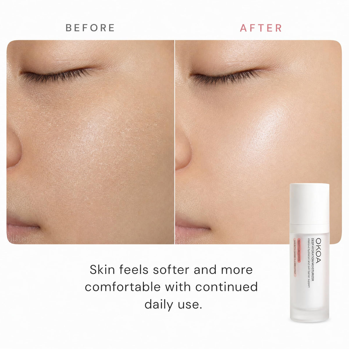 OKOA SKIN Deep Hydration Moisturizer Firming Anti Aging - OKOA Official Imagery - 5
