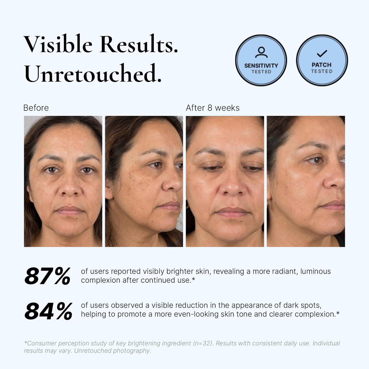 EnaSkin Dark Spot Corrector 5% Tranexamic Acid Serum