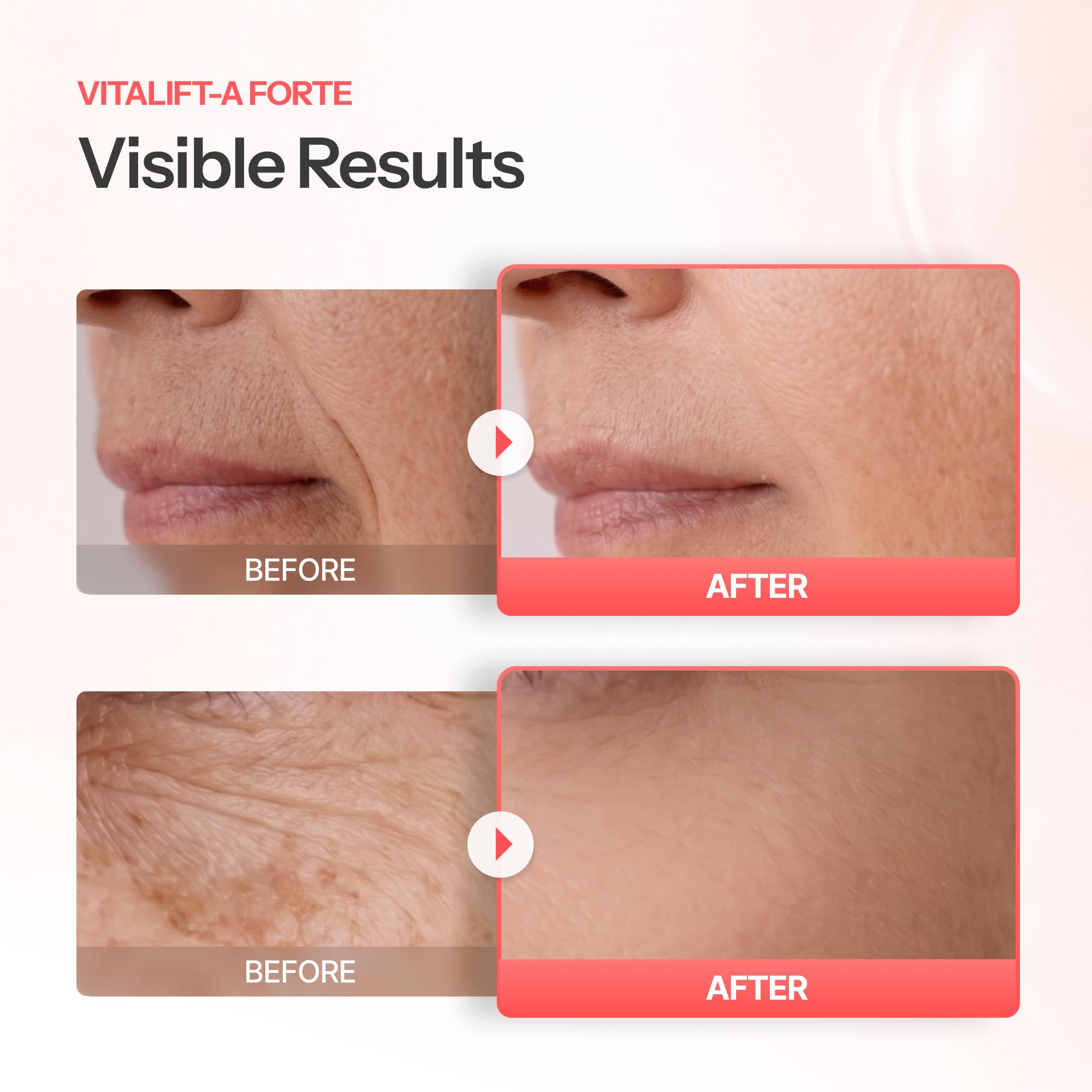 Dr Different VITALIFT A Forte Retinal 0 1 Intensive Anti - Dr.Different Official Imagery - 5