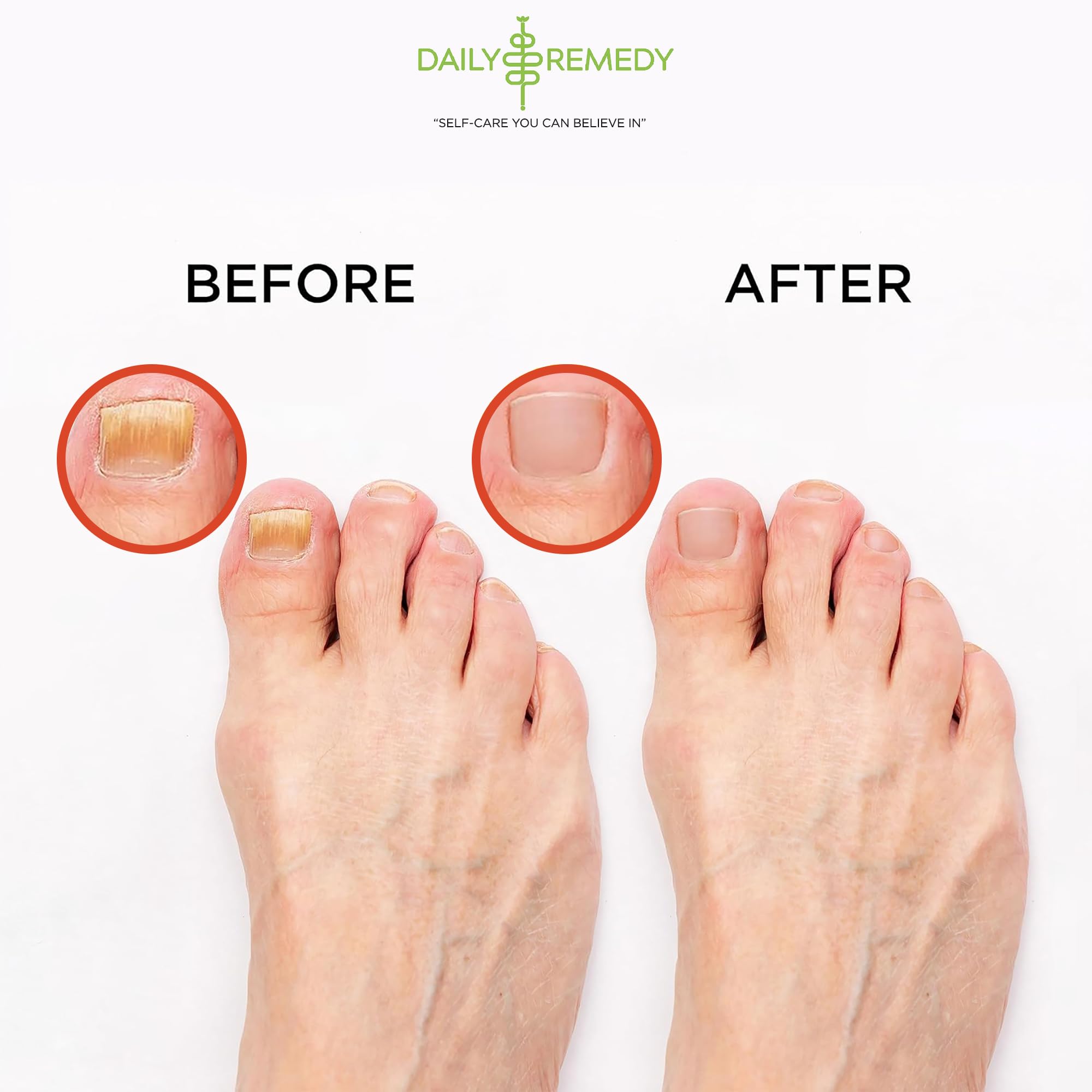 Daily Remedy Muscle Relief Foot Soak with Epsom Salt 1lb