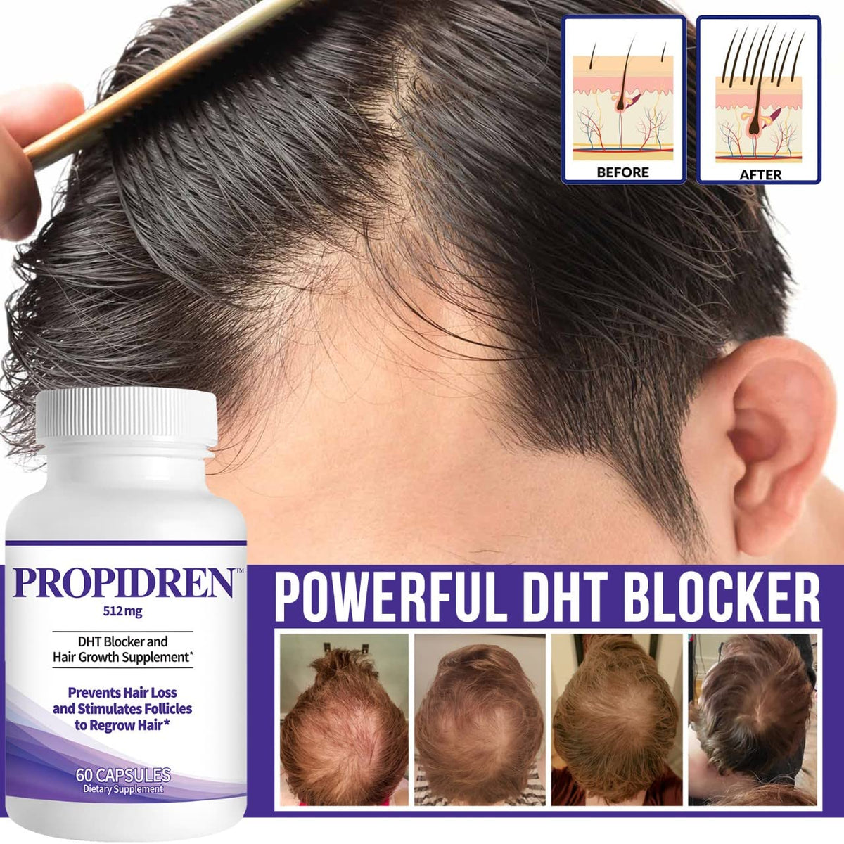 Propidren DHT Blocker Hair Growth Pills To Stop Hair Loss - Pronexa Official Imagery - 4