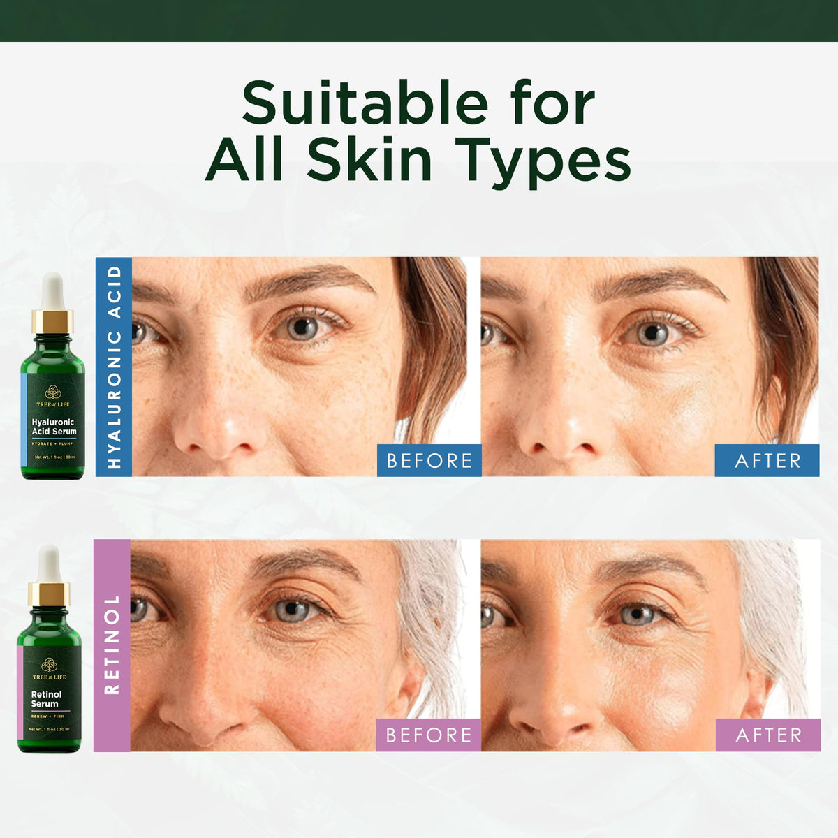 Tree of Life Face Serum Skin Care Set Hyaluronic Acid - Tree of Life Official Imagery - 4