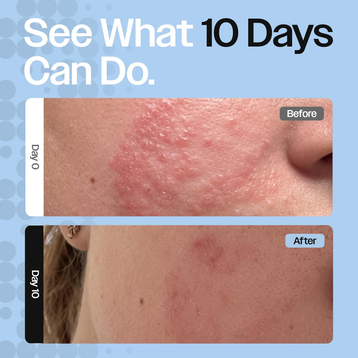 Barrier Repair Cream for Dry Sensitive Eczema Prone Skin - CELRIV Official Imagery - 7