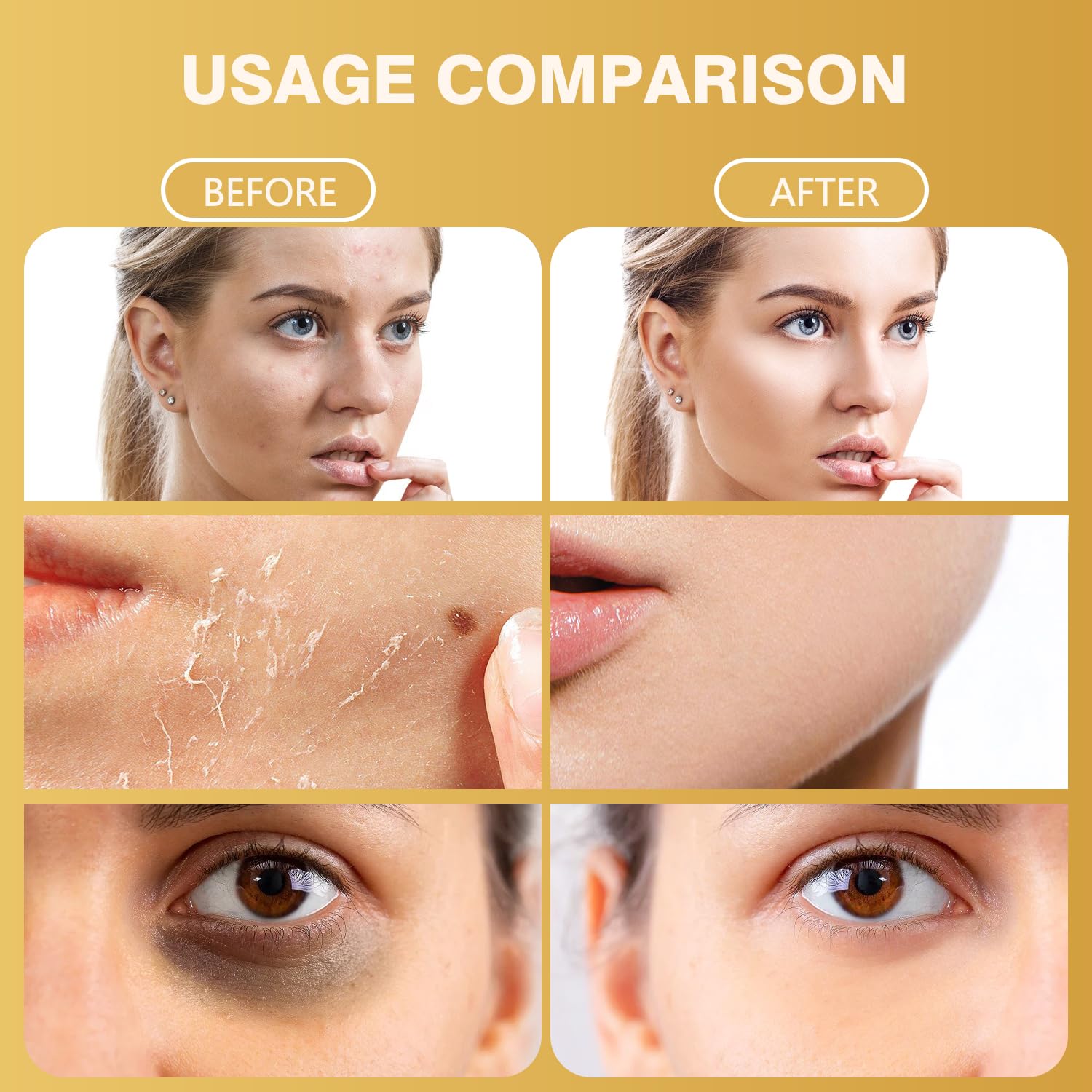 Bee Venom Skin Treatment Cream - lzzch1219 Official Imagery - 5