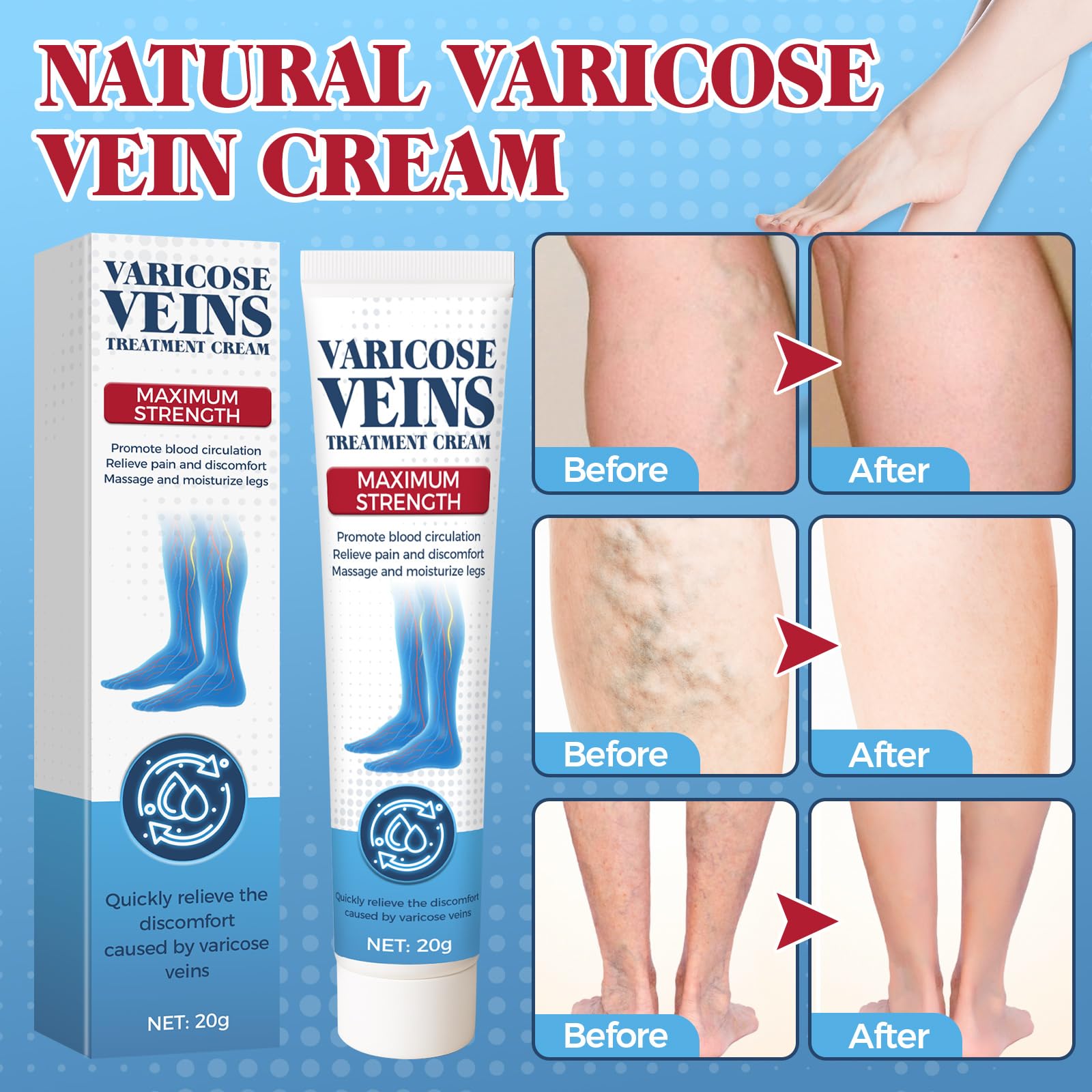 Bellisinno varicose veins cream for legs and spider veins, a moisturizing skin cream with soothing ingredients.