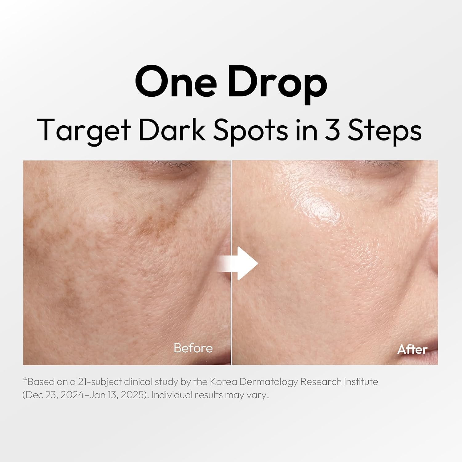 LAYERLAB Clear Tone Dark Spot Serum Niacinamide 7 Face Serum - LAYERLAB Official Imagery - 3