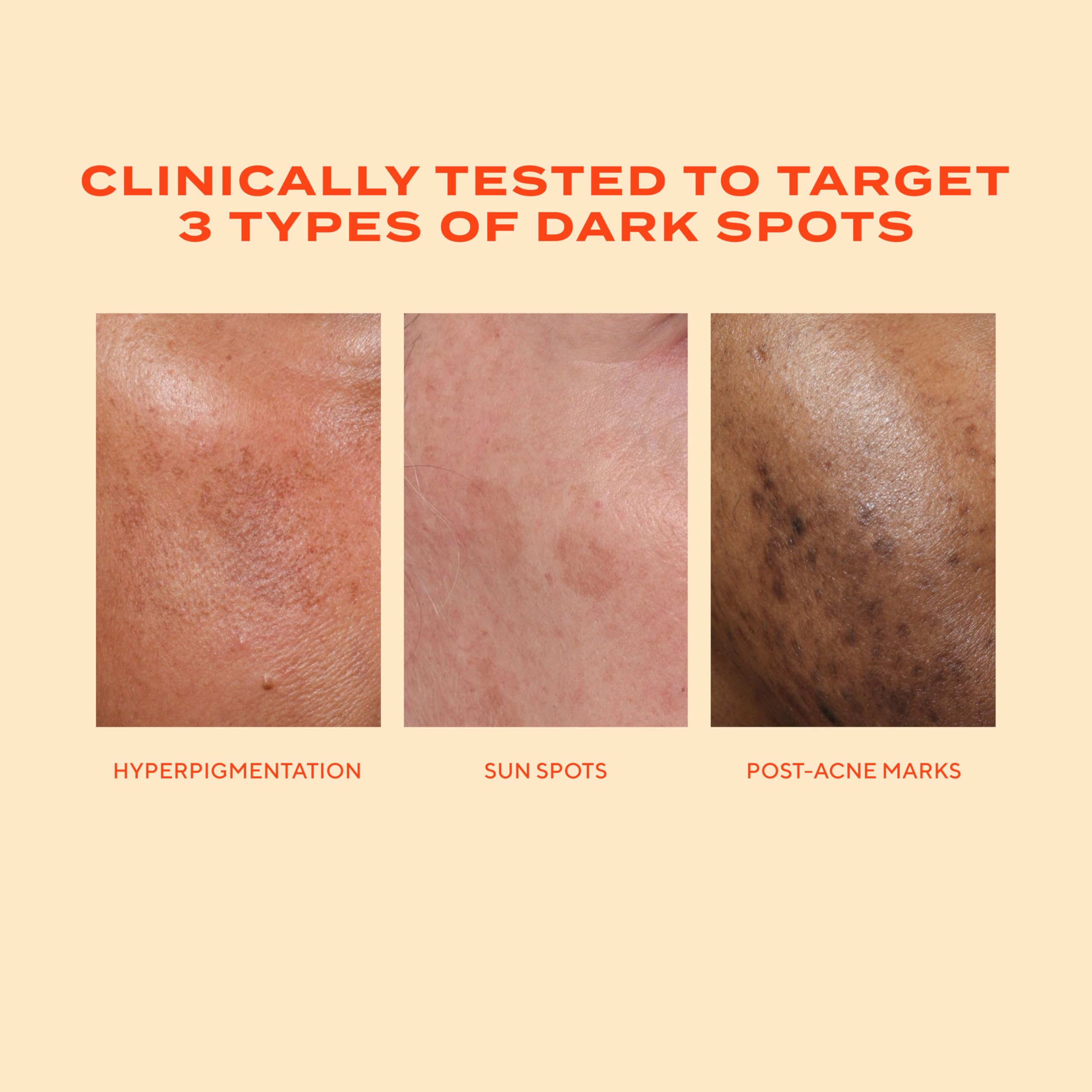 Murad Rapid Dark Spot Correcting Serum 1 oz