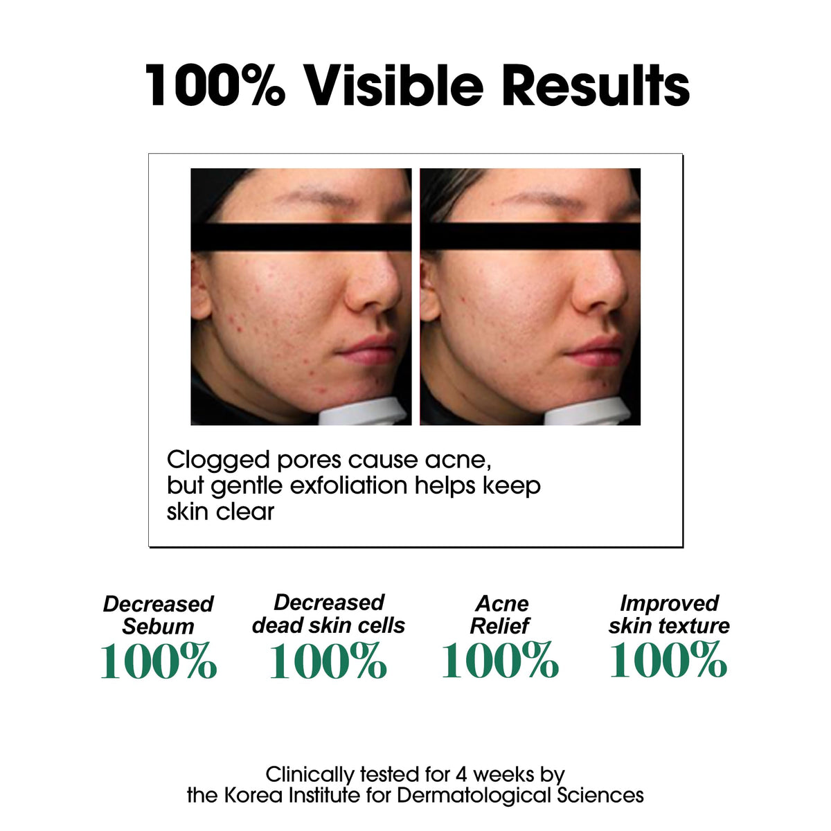 SOME BY MI AHA BHA PHA 30 Days Miracle Toner Pack of 2 - SOME BY MI Official Imagery - 5