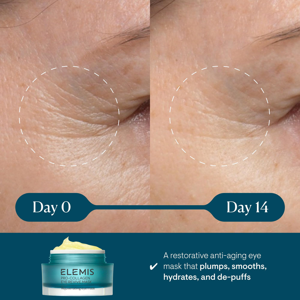 ELEMIS Pro Collagen Eye Revive Mask - Premium Selection Official Imagery - 3