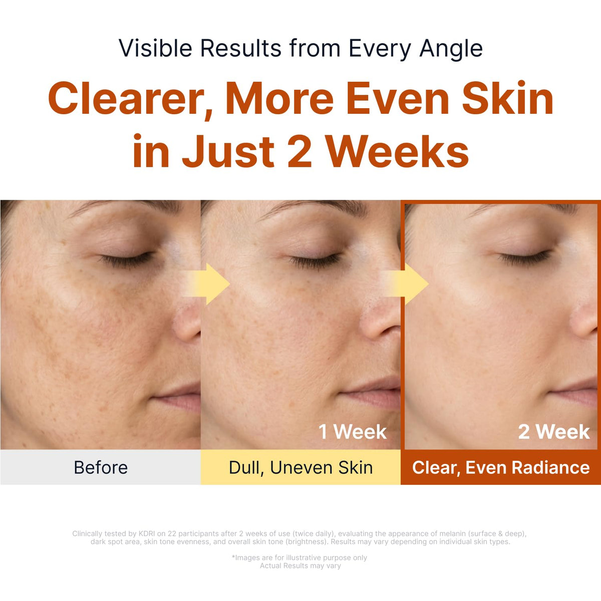 SUNGBOON EDITOR Glow Intensive Kojic Acid Ampoule Turmeric - SUNGBOON EDITOR Official Imagery - 4