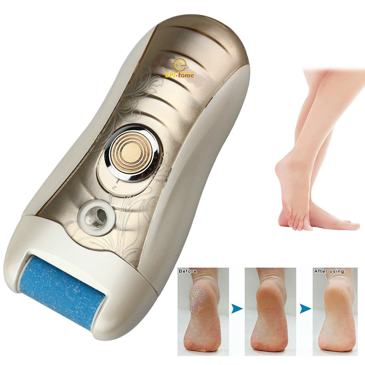 EPITOME Callus Remover Electric Ladies Shaver Dual Voltage - Epitome Official Imagery - 3