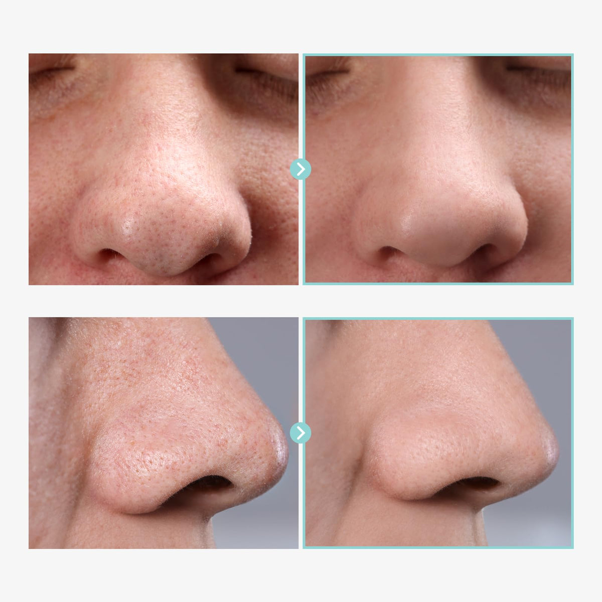 TOSOWOONG Pore Tightening Serum Pore Minimizer for Face - TOSOWOONG Official Imagery - 5