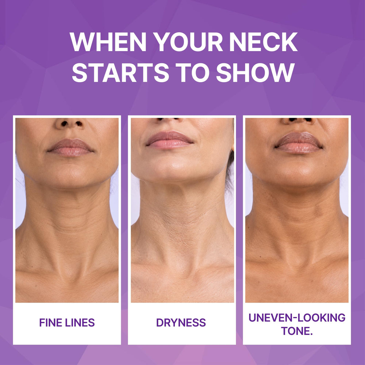 Korean Neck Firming Cream Neck Tightening and Lifting Cream - Ashania Official Imagery - 4