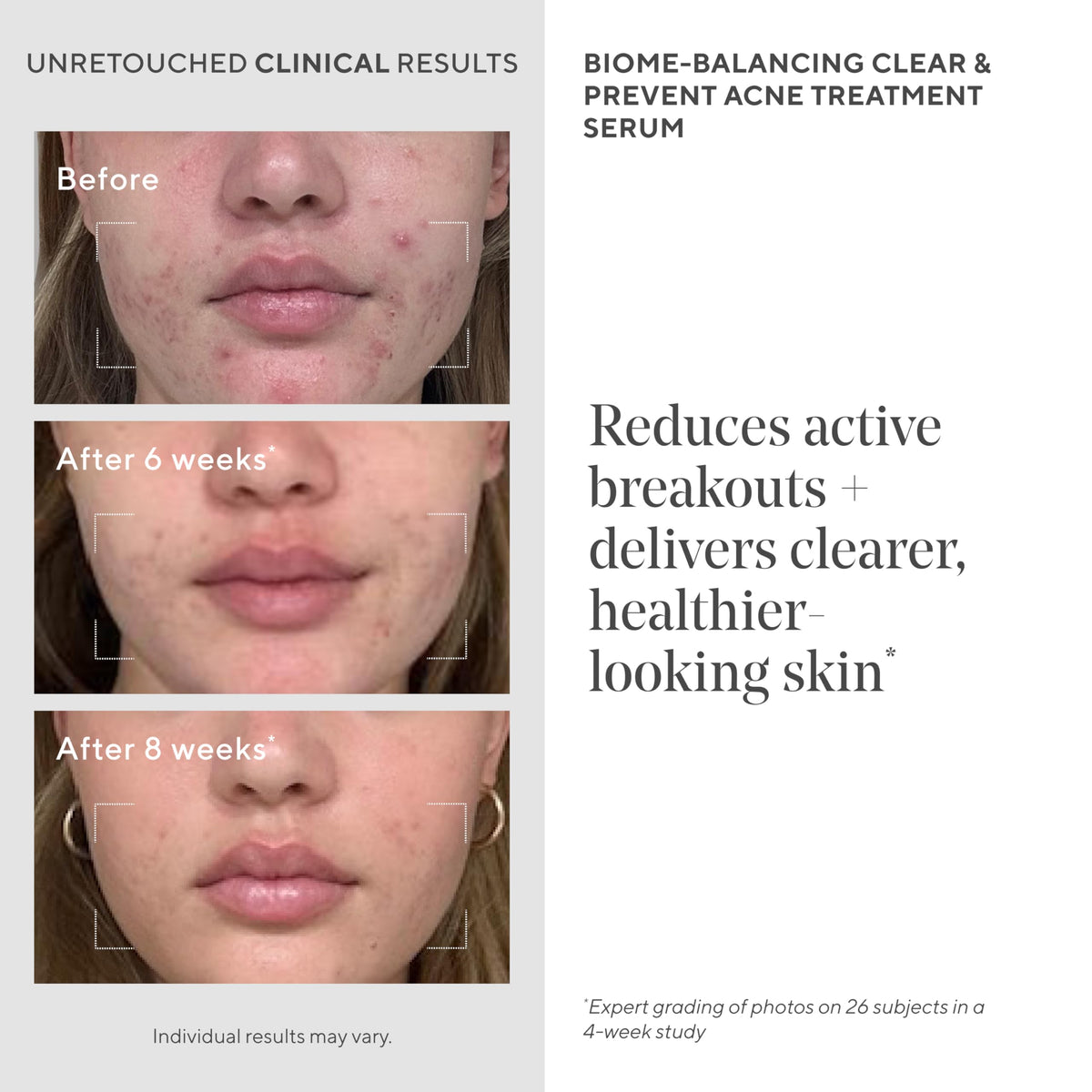 Murad Biome Balancing Acne Serum - Premium Selection Official Imagery - 5