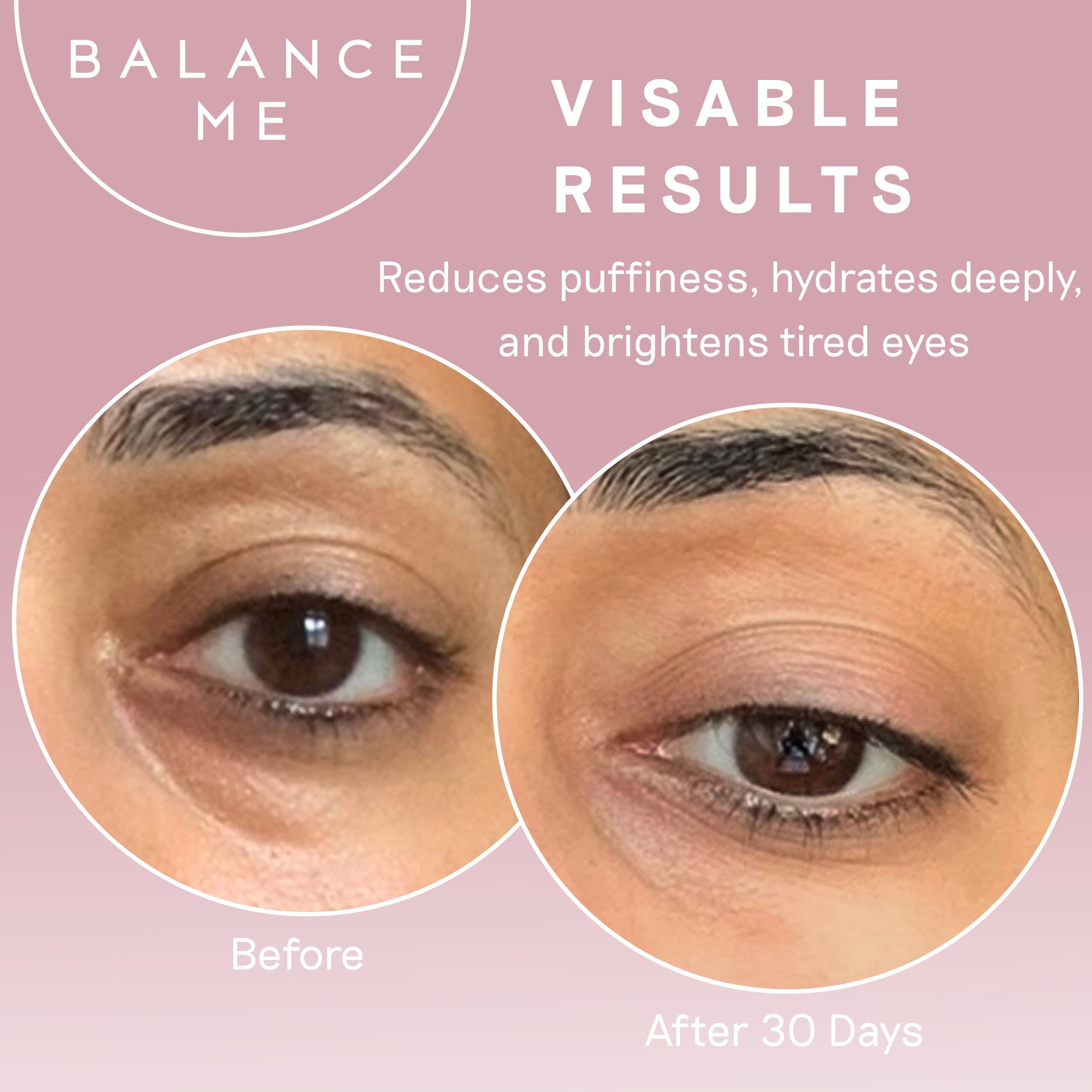 Balance Me Wonder Eye Cream 0 5 fl oz For Dark Circles - Balance Me Official Imagery - 6