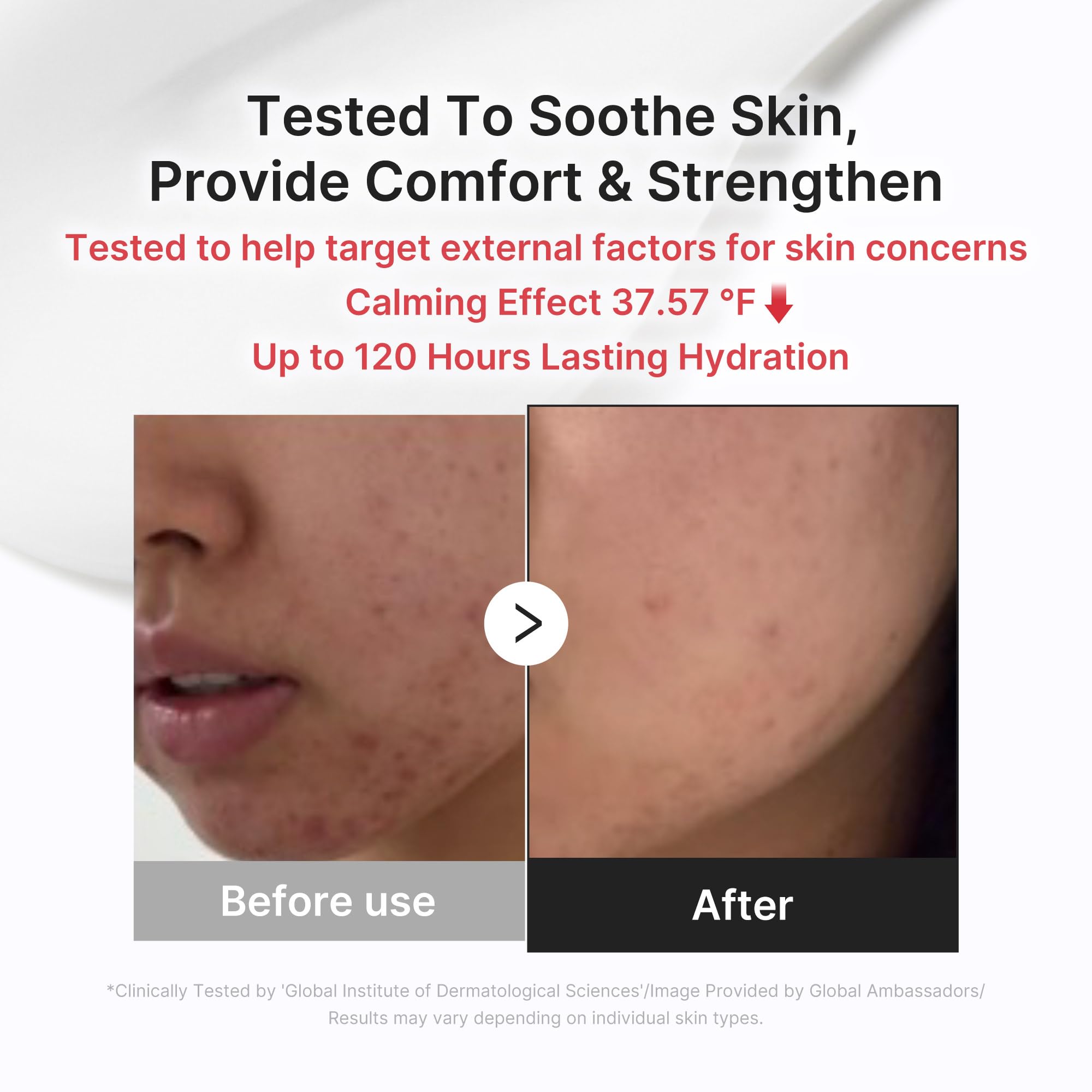 medicube Clarifying Pad & Soothing Cream Duo - medicube Official Product View 6