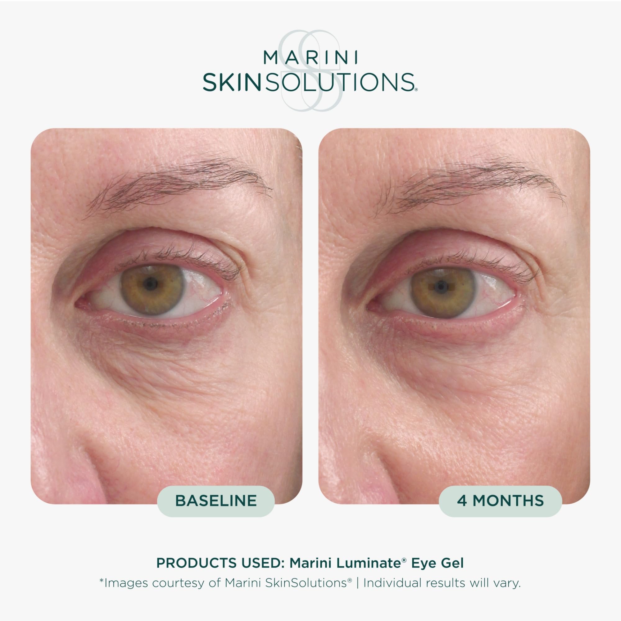 Marini SkinSolutions Luminate Eye Gel - Marini SkinSolutions Official Imagery - 4