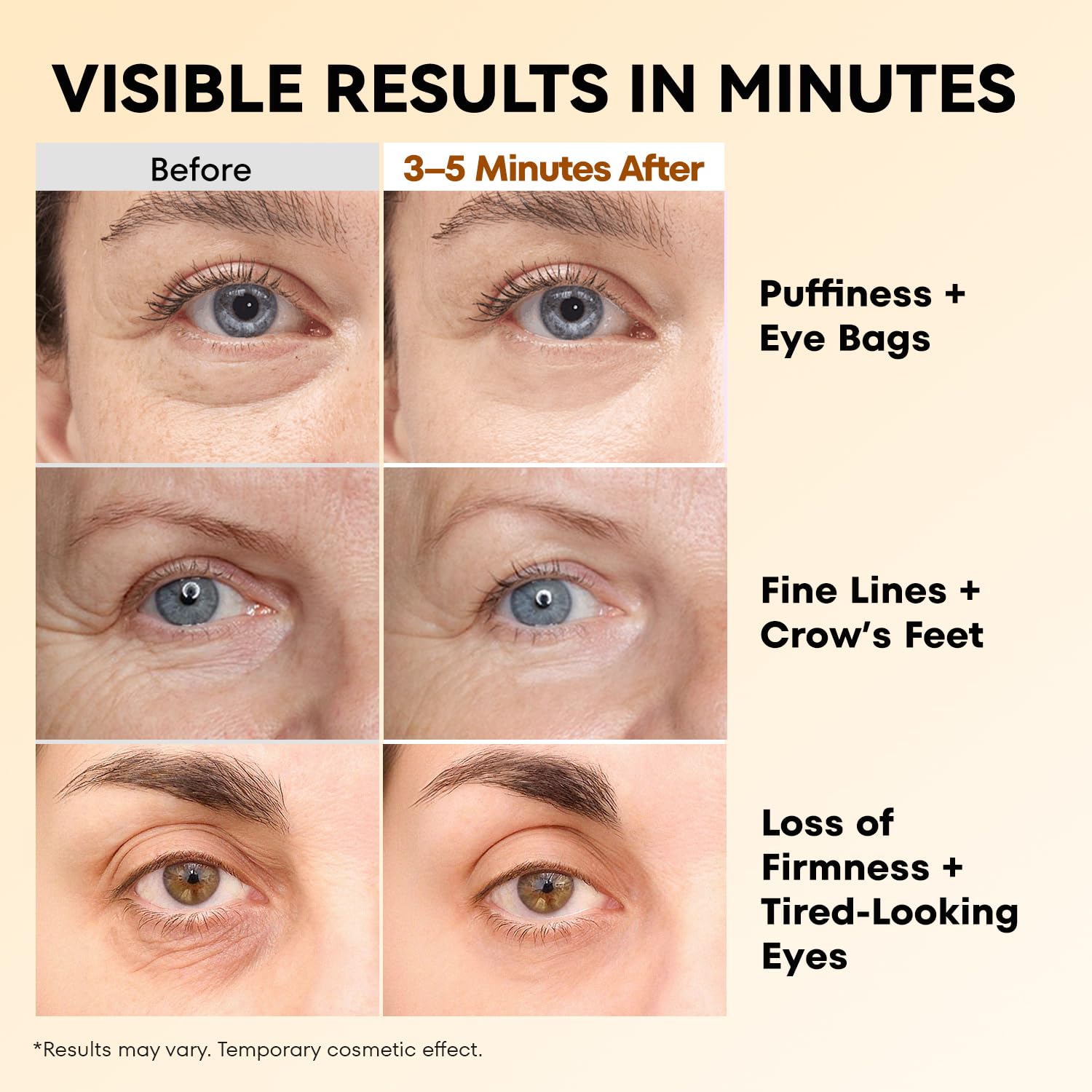 RONKIE Instant Firm Eye Tightener Upgraded Formula for Women - RONKIE Official Imagery - 4