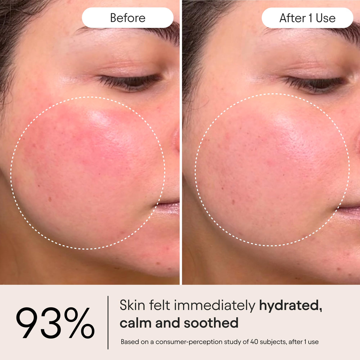 ALPYN Firming Peptide Barrier Repair Cream For Eczema - Alpyn Beauty Official Imagery - 5